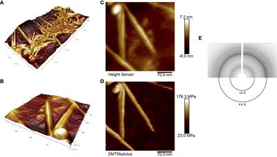 RopB protein of Rhizobium leguminosarum bv. viciae adopts amyloid state during symbiotic interactions with pea (Pisum sativum L.)